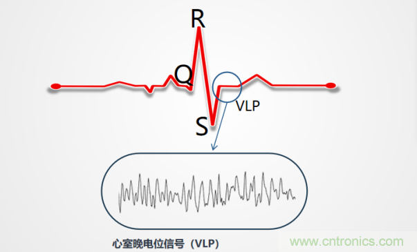 解決心電監(jiān)測行業(yè)難題，曼森伯格的濾波技術(shù)獲國家知識產(chǎn)權(quán)局發(fā)明授權(quán)